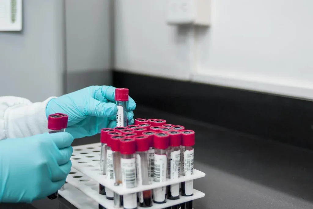 Probówki z próbkami krwi w statywie w laboratorium, badanie lipidogramu i poziomu LDL