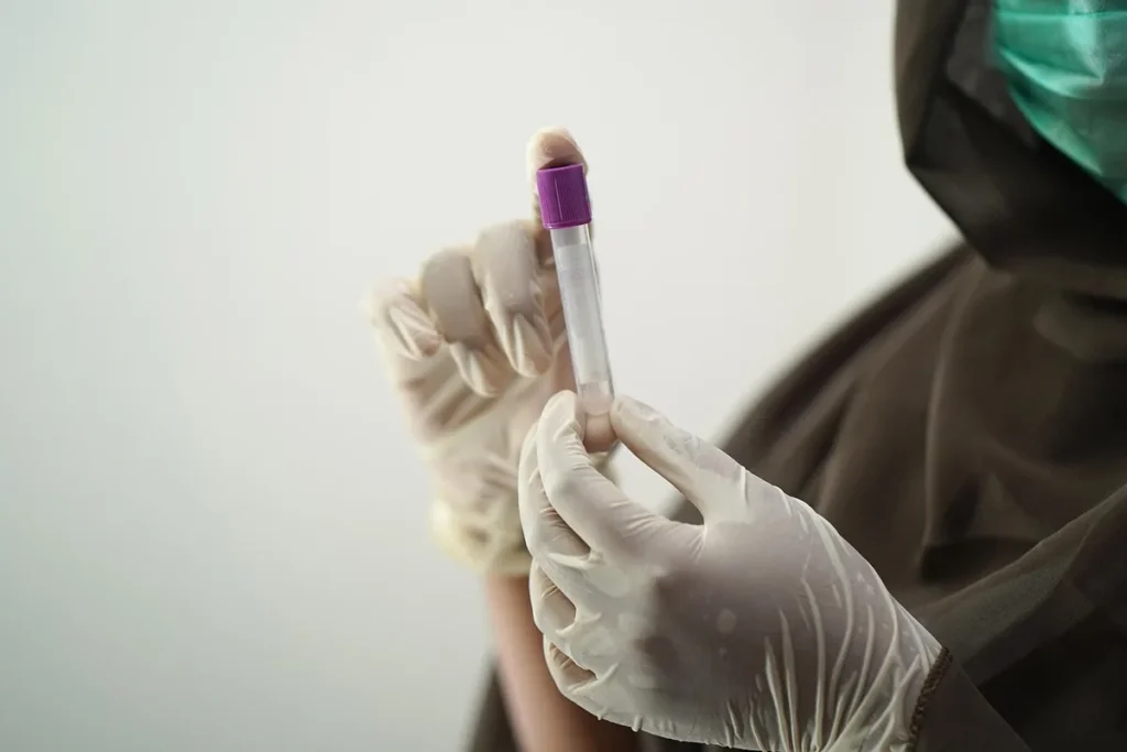 Probówka z próbką krwi w dłoniach w rękawiczkach: badanie stężenia 25(OH)D i norma witaminy D